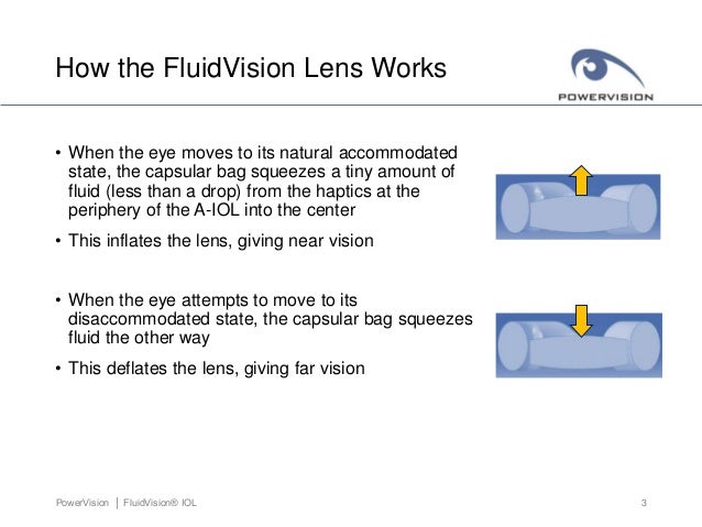 Fluidvision accommodating iol power vision